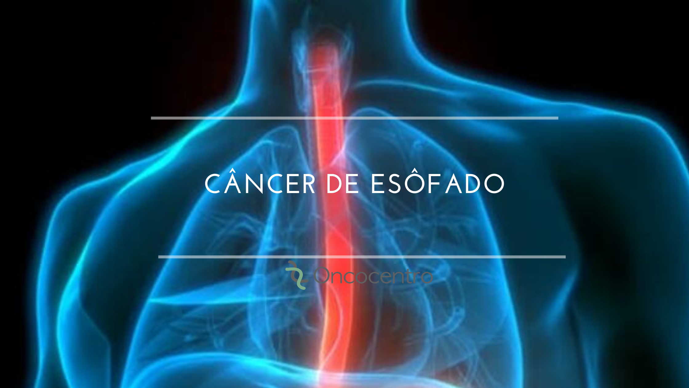 Cancer De Esofago